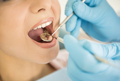 Лікування зубів в Черкасах